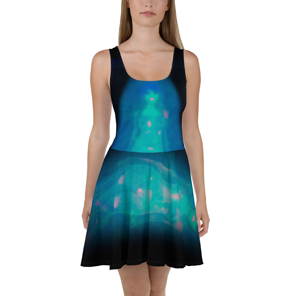 Skater Dress